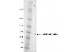 Image no. 2 for anti-Heterogeneous Nuclear Ribonucleoprotein A1 (HNRNPA1) antibody (ABIN108609)