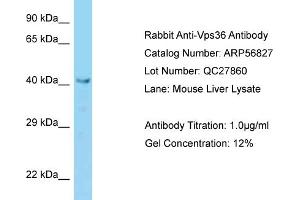 VPS36 抗体  (N-Term)