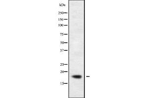 Western blot analysis of KLRC2/4 using HeLa whole cell lysates