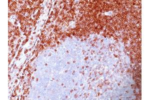Image no. 2 for anti-B-Cell CLL/lymphoma 2 (BCL2) (AA 41-54) antibody (ABIN6940492)