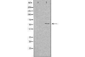 Image no. 1 for anti-Fibulin 3 (FBLN3) (Internal Region) antibody (ABIN6257847)