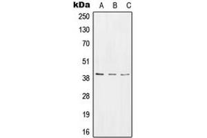 Image no. 2 for anti-RNA terminal Phosphate Cyclase Domain 1 (RTCD1) (C-Term) antibody (ABIN2705198)