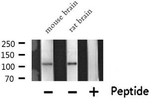 Image no. 1 for anti-Protein Kinase N1 (PKN1) antibody (ABIN6257420)