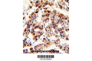 Image no. 2 for anti-Ornithine Carbamoyltransferase (OTC) (AA 71-98) antibody (ABIN390915)