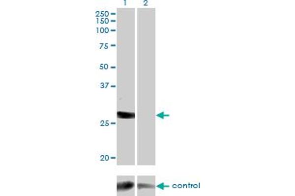 Deoxyguanosine Kinase antibody  (AA 1-89)