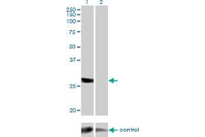Image no. 2 for anti-Deoxyguanosine Kinase (DGUOK) (AA 1-89) antibody (ABIN560599)