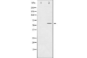 Image no. 1 for anti-Tyrosine Hydroxylase (TH) (pSer31) antibody (ABIN6255191)