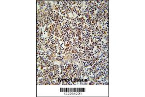 Immunohistochemistry (IHC) image for anti-Immune Receptor Expressed On Myeloid Cells 1 (IREM1) antibody (ABIN2158128)