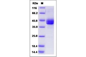 Image no. 1 for Regenerating Islet-Derived 1 alpha (REG1A) (AA 1-100) protein (Fc Tag) (ABIN2009446)