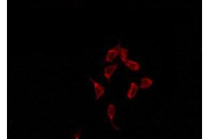 Image no. 1 for anti-Acrosin Binding Protein (ACRBP) antibody (ABIN6258496)