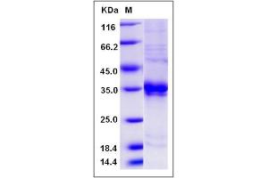 Image no. 1 for CXADR-Like Membrane Protein (CLMP) (AA 1-232) (Active) protein (His tag) (ABIN2009324)