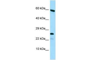 anti-Heparan-alpha-Glucosaminide N-Acetyltransferase (HGSNAT) (N-Term) antibody