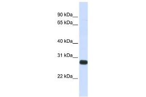 Image no. 1 for anti-serine Peptidase Inhibitor, Kunitz Type, 2 (SPINT2) (Middle Region) antibody (ABIN635895)