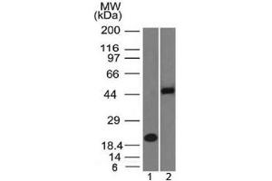 Image no. 3 for anti-Paired Box 8 (PAX8) (AA 60-261) antibody (ABIN4949848)