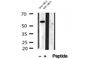 Image no. 1 for anti-Tectonic Family Member 1 (TCTN1) (N-Term) antibody (ABIN6265507)