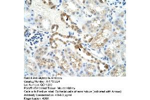 Image no. 3 for anti-Myb-Binding Protein 1A (MYBBP1A) (C-Term) antibody (ABIN2780004)