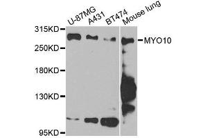 Image no. 1 for anti-Myosin X (MYO10) antibody (ABIN6144270)