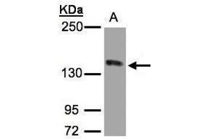 WB Image Sample(30 ug whole cell lysate) A:HeLa S3, 5% SDS PAGE antibody diluted at 1:1000