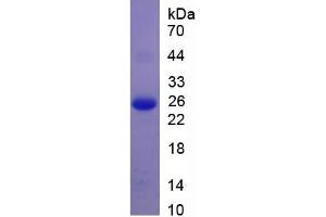 Image no. 2 for Apolipoprotein B (APOB) ELISA Kit (ABIN6730915)