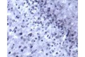 Image no. 1 for anti-Vesicle-Associated Membrane Protein 2 (Synaptobrevin 2) (VAMP2) (AA 10-60) antibody (ABIN351357)