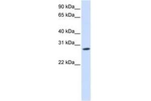 Image no. 1 for anti-Kv Channel Interacting Protein 4 (KCNIP4) (N-Term) antibody (ABIN6742500)