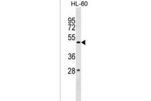 ZBTB47 Antibody (Center) (ABIN1538012 and ABIN2849876) western blot analysis in HL-60 cell line lysates (35 μg/lane).