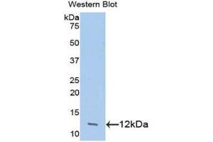 Image no. 1 for anti-Chemokine (C-C Motif) Ligand 24 (CCL24) (AA 27-119) antibody (ABIN1078373)