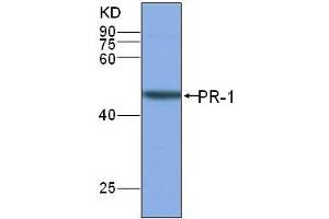 Image no. 1 for anti-Transmembrane Protein 37 (TMEM37) antibody (ABIN1854667)