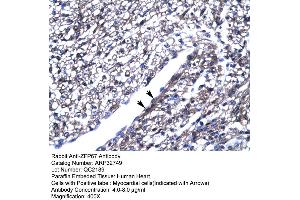 Image no. 2 for anti-Zinc Finger and BTB Domain Containing 7B (ZBTB7B) (Middle Region) antibody (ABIN2777563)