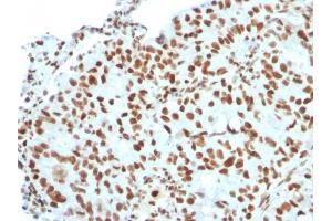 Image no. 3 for anti-BMI1 Polycomb Ring Finger Oncogene (BMI1) (AA 142-326) antibody (ABIN6940582)
