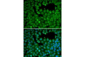 Immunofluorescence (IF) image for anti-Neuroepithelial Cell Transforming 1 (NET1) (AA 1-300) antibody (ABIN1513253)