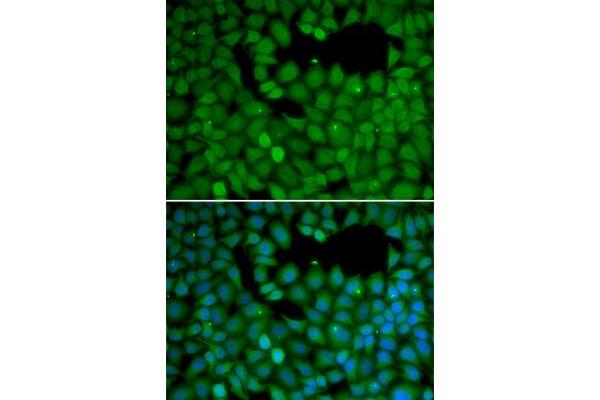 anti-Neuroepithelial Cell Transforming 1 (NET1) antibody