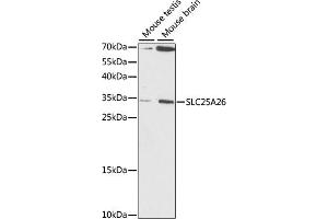 SLC25A26 Antikörper  (AA 105-185)