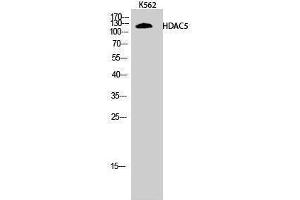 Image no. 1 for anti-Histone Deacetylase 5 (HDAC5) (Tyr512) antibody (ABIN3184988)