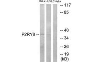 Image no. 1 for anti-Purinergic Receptor P2Y, G-Protein Coupled, 8 (P2RY8) (AA 192-241) antibody (ABIN1535975)