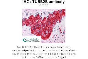 Image no. 2 for anti-Tubulin, beta 2B (TUBB2B) antibody (ABIN1724373)