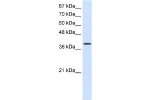 Image no. 1 for anti-Eukaryotic Translation Initiation Factor 4 gamma 2 (EIF4G2) (C-Term) antibody (ABIN2778773)