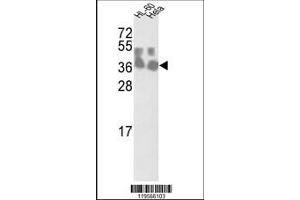 Image no. 1 for anti-Chloride Channel, Nucleotide-Sensitive, 1A (CLNS1A) (AA 148-176) antibody (ABIN390420)