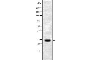 Image no. 1 for anti-SERTA Domain Containing 1 (SERTAD1) (Internal Region) antibody (ABIN6264966)