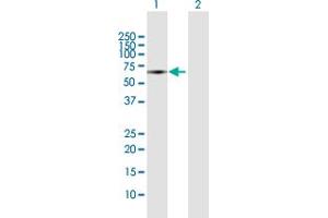 Image no. 3 for anti-Suppressor of Cytokine Signaling 6 (SOCS6) (AA 1-535) antibody (ABIN948788)