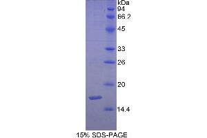 Image no. 1 for Sema Domain, Immunoglobulin Domain (Ig), Short Basic Domain, Secreted, (Semaphorin) 3F (SEMA3F) (AA 604-785) protein (His tag) (ABIN1080789)