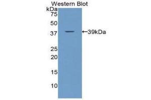 anti-Calcitonin (Calca) (AA 25-85) antibody