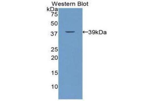 anti-Calcitonin (Calca) (AA 25-85) antibody