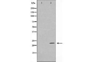 Image no. 1 for anti-CD69 (CD69) antibody (ABIN6260640)