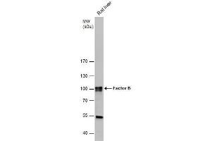 Image no. 1 for anti-Complement Factor B (CFB) (Internal Region) antibody (ABIN2855659)