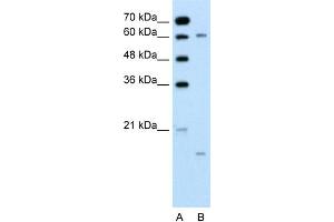 anti-Cytochrome P450, Family 4, Subfamily A, Polypeptide 22 (CYP4A22) (N-Term) antibody
