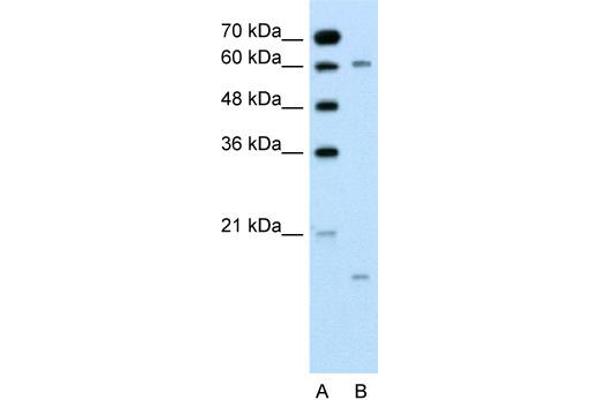 anti-Cytochrome P450, Family 4, Subfamily A, Polypeptide 22 (CYP4A22) (N-Term) antibody