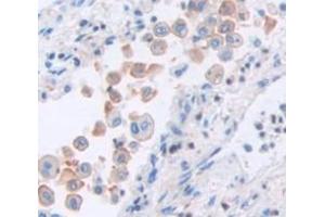 Calsyntenin 2 antibody  (AA 31-271)