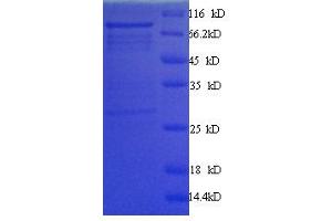 Image no. 1 for Myc Proto-Oncogene protein (MYC) (AA 1-439), (full length) protein (GST tag) (ABIN1047412)