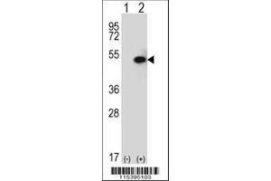 Image no. 3 for anti-Sphingosine Kinase 1 (SPHK1) (AA 313-343), (C-Term) antibody (ABIN652302)